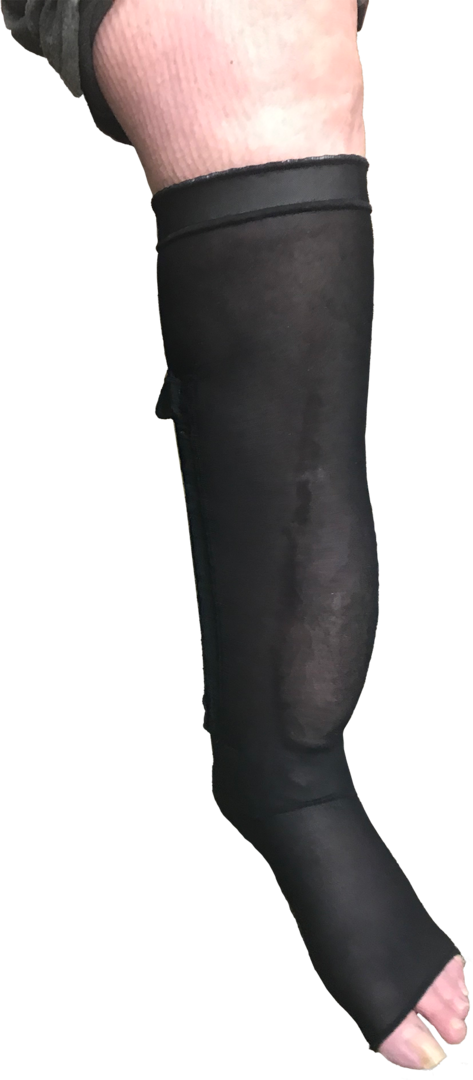 Burn Garment